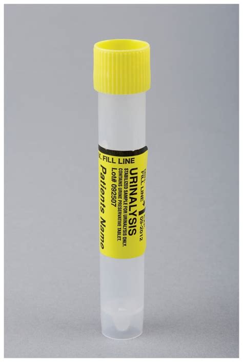 torn seal on urinalysis test vial|fatal urine collection.